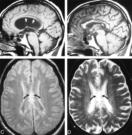 fig 3.