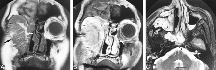 fig 1.