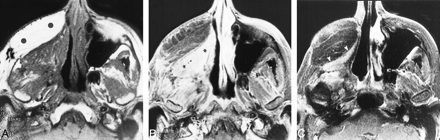 fig 3.