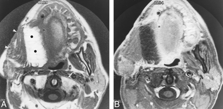 fig 4.