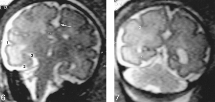 fig 6.