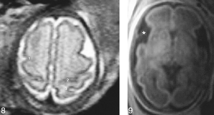 fig 8.