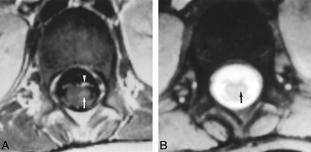 fig 1.