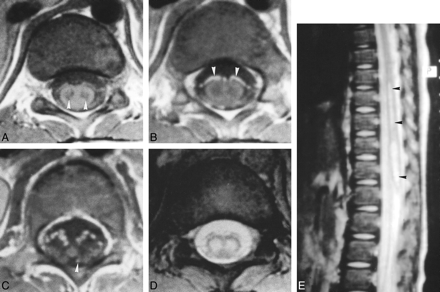 fig 2.