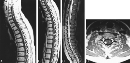 fig 3.