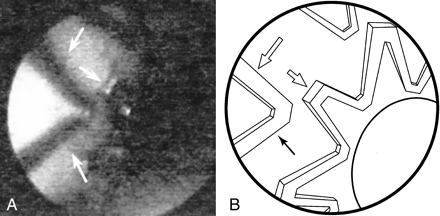fig 3.