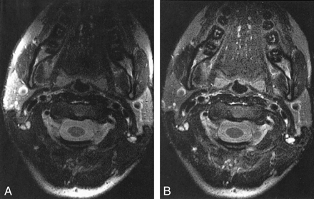 fig 4.