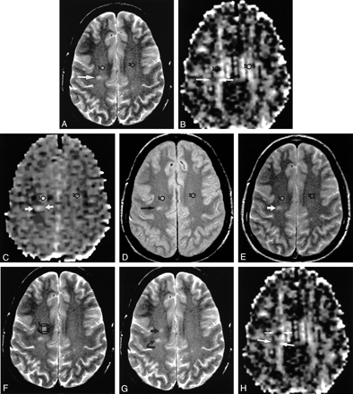 fig 1.