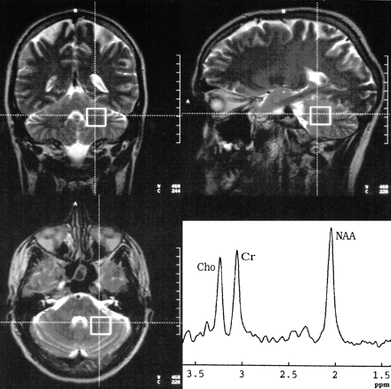 fig 2.