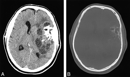 fig 1.