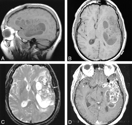 fig 2.