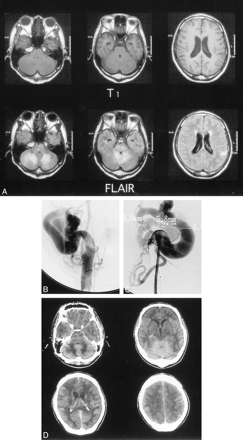 fig 1.