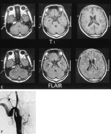 fig 1.