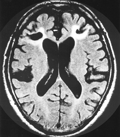 fig 2.