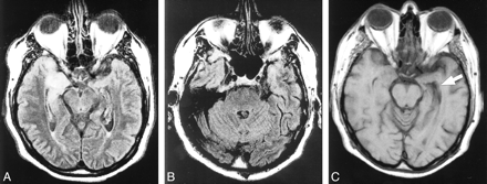 fig 1.