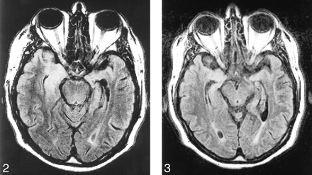 fig 2.