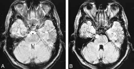 fig 7.