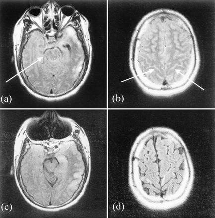 fig 1.