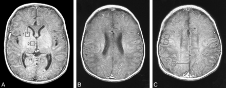 fig 1.