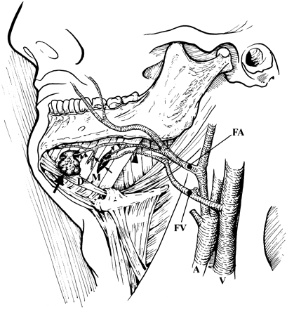 fig 5.