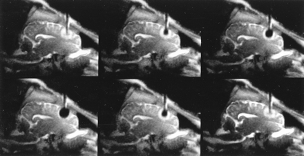 fig 3.