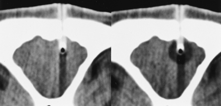 fig 5.