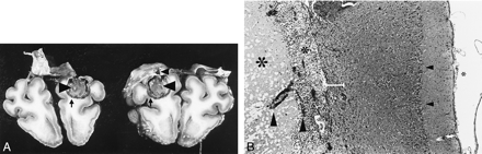 fig 7.