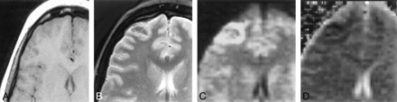 fig 1.
