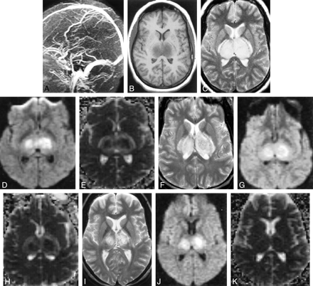 fig 4.