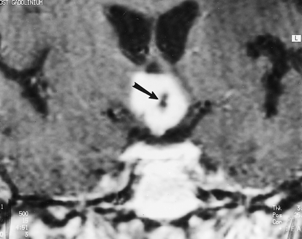 fig 4.