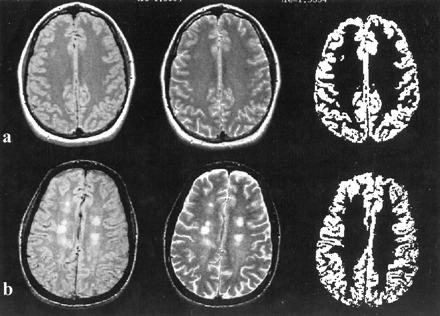fig 1.