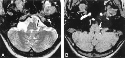fig 3.