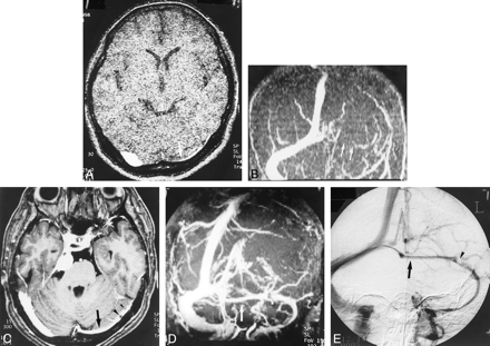 fig 5.