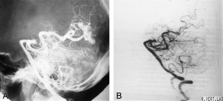fig 1.