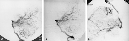 fig 3.