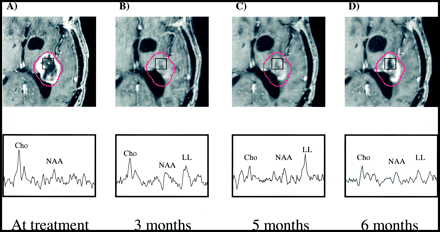 fig 1.