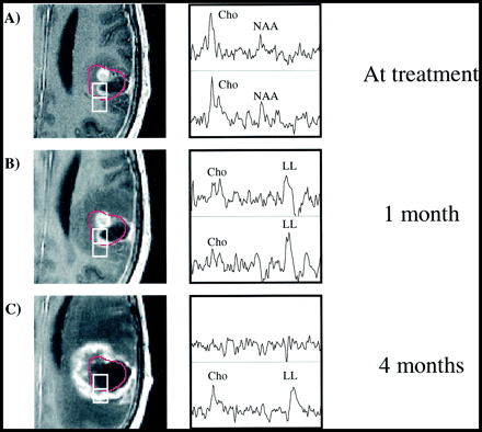 fig 2.