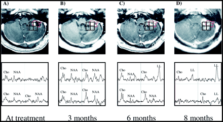 fig 3.