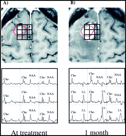 fig 4.