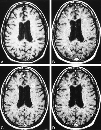 fig 1.