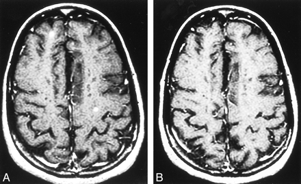 fig 2.