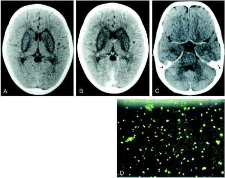 fig 1.