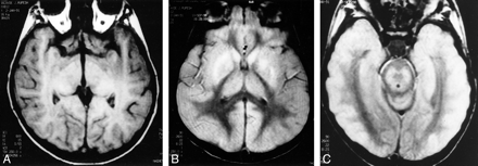 fig 2.