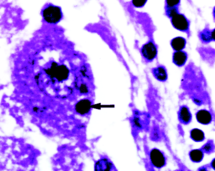 fig 3.