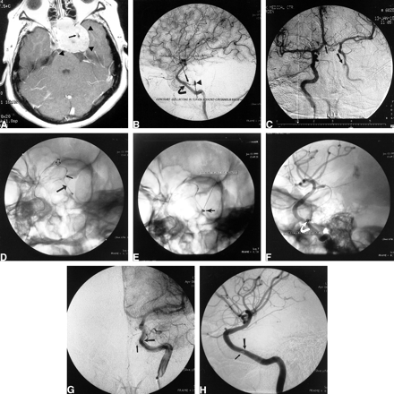 fig 2.