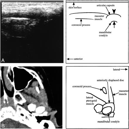 fig 5.