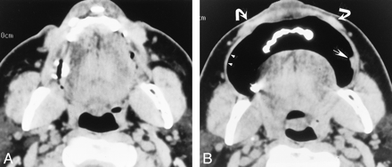 fig 2.