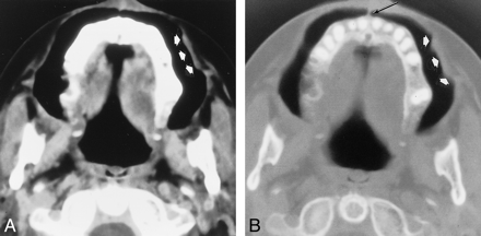 fig 5.