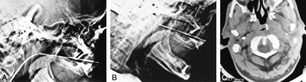 fig 1.