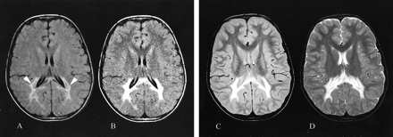fig 1.
